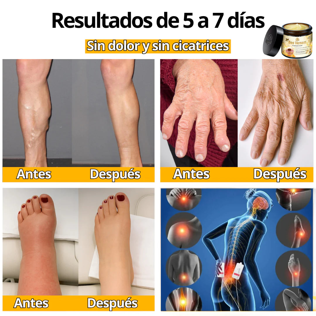 BeeRelief