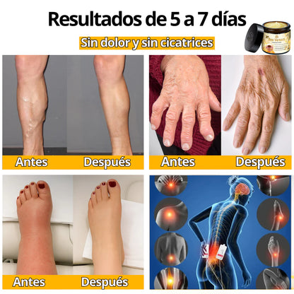 BeeRelief