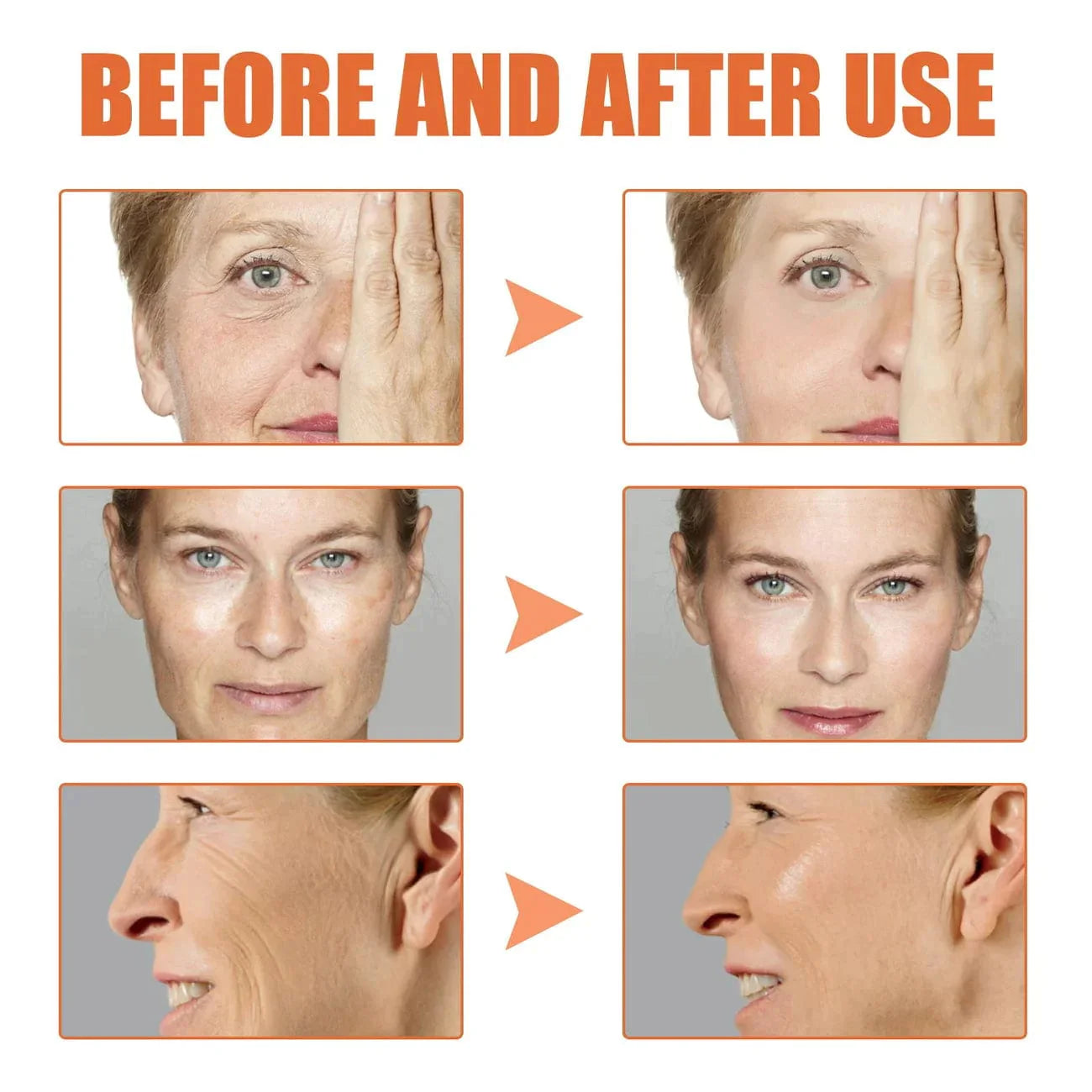 Belleza al Doble – Sueros Botox