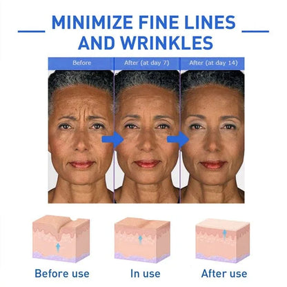 Belleza al Doble – Sueros Botox