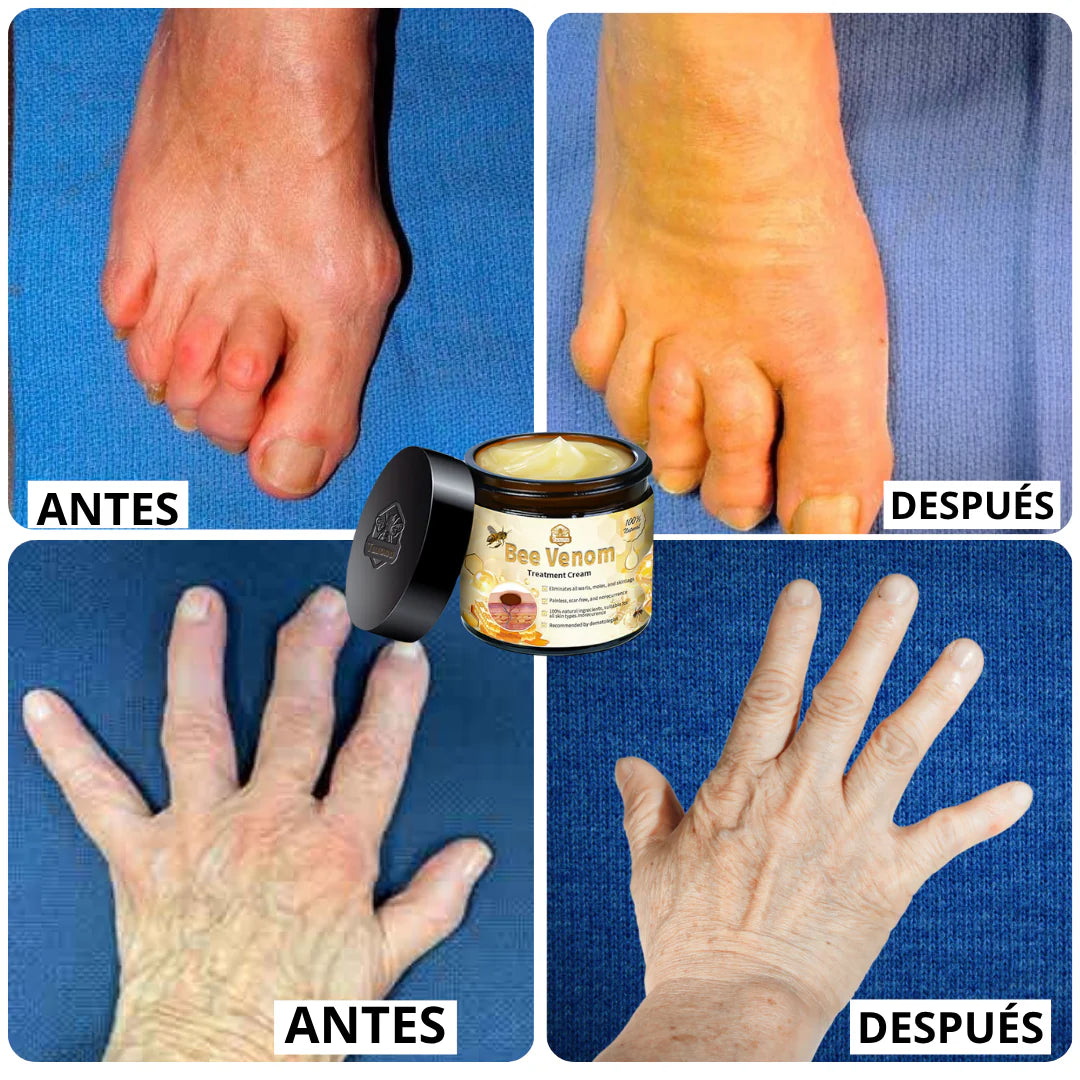 BeeRelief