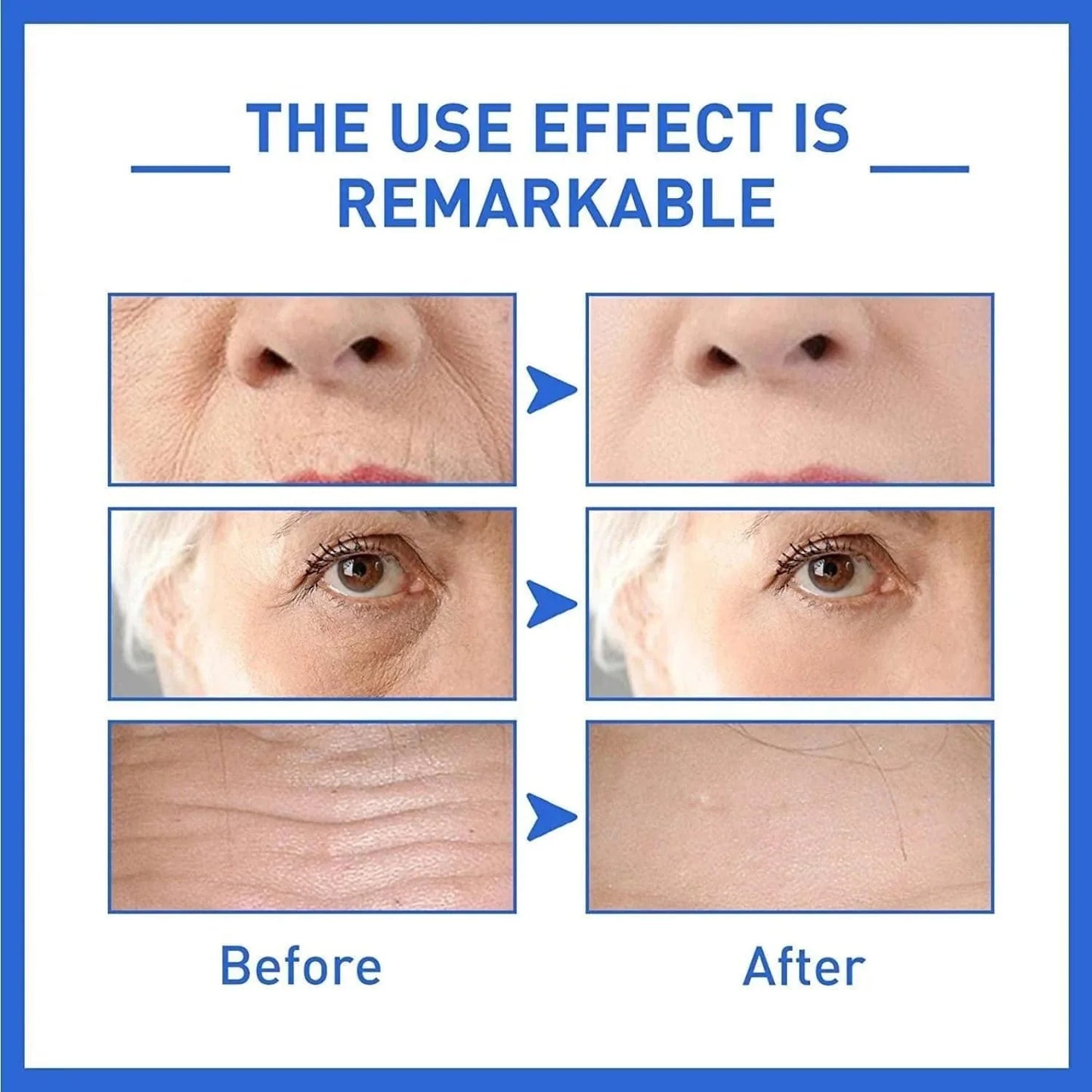 Belleza al Doble – Sueros Botox